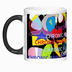 Chronic Pain Syndrome Morph Mug by FunWithFibro